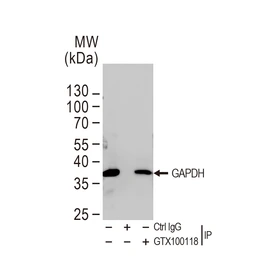 Anti-GAPDH antibody used in Immunoprecipitation (IP). GTX100118