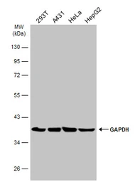 Anti-GAPDH antibody used in Western Blot (WB). GTX100118