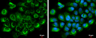 Anti-Albumin antibody used in Immunocytochemistry/ Immunofluorescence (ICC/IF). GTX102419