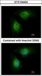 Anti-CYP1B1 antibody used in Immunocytochemistry/ Immunofluorescence (ICC/IF). GTX104424
