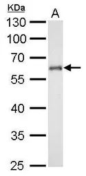 Anti-CYP1B1 antibody used in Western Blot (WB). GTX104424