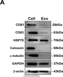 Anti-beta Actin antibody used in Western Blot (WB). GTX109639