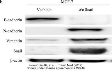 Anti-beta Actin antibody used in Western Blot (WB). GTX109639