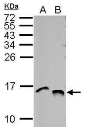 Anti-Histone H4K5K8K12K16ac (acetyl Lys5/Lys8/Lys12/Lys16) antibody used in Western Blot (WB). GTX122653