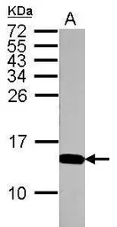 Anti-Histone H4K5K8K12K16ac (acetyl Lys5/Lys8/Lys12/Lys16) antibody used in Western Blot (WB). GTX122653