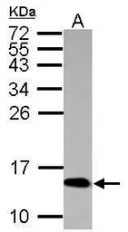 Anti-Histone H4K5K8K12K16ac (acetyl Lys5/Lys8/Lys12/Lys16) antibody used in Western Blot (WB). GTX122653