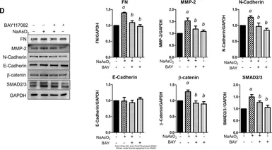 Anti-N-Cadherin antibody used in Western Blot (WB). GTX127345