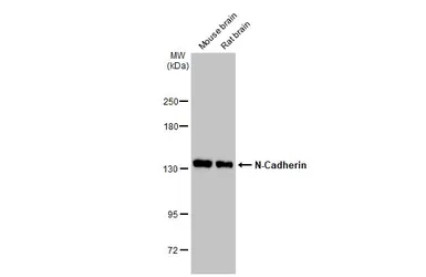 Anti-N-Cadherin antibody used in Western Blot (WB). GTX127345