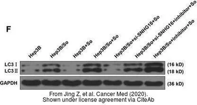 Anti-LC3B antibody used in Western Blot (WB). GTX127375