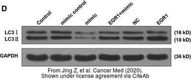 Anti-LC3B antibody used in Western Blot (WB). GTX127375