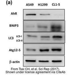 Anti-LC3B antibody used in Western Blot (WB). GTX127375