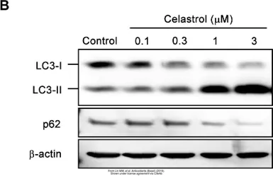 Anti-LC3B antibody used in Western Blot (WB). GTX127375