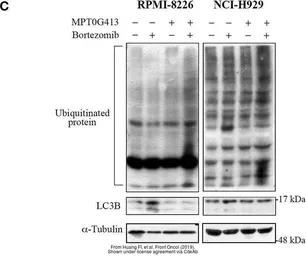 Anti-LC3B antibody used in Western Blot (WB). GTX127375