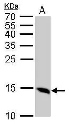 Anti-LC3B antibody used in Western Blot (WB). GTX127375