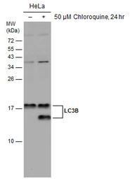 Anti-LC3B antibody used in Western Blot (WB). GTX127375