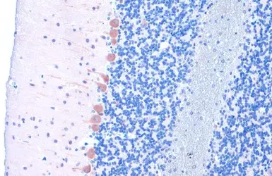 Anti-LC3B antibody used in IHC (Paraffin sections) (IHC-P). GTX127375