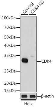 (KO Validated) CDK4 Polyclonal Antibody - 1