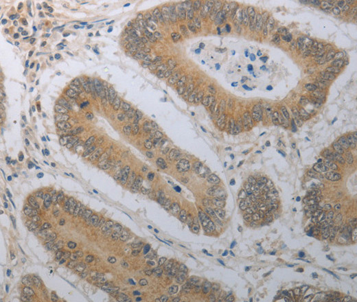 SHH Polyclonal Antibody - 2