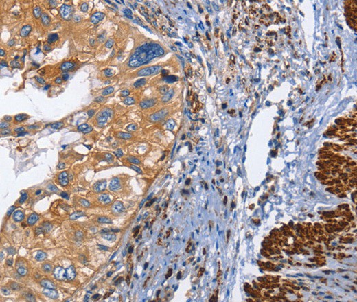 CD45 Polyclonal Antibody - 2
