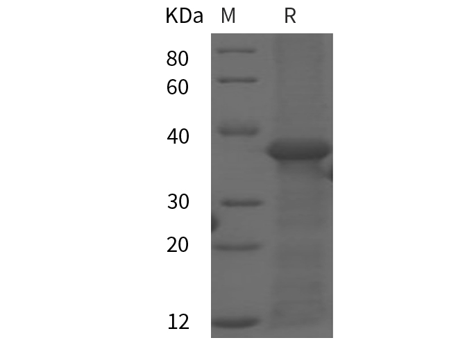 Recombinant Rat C4 Protein (His Tag) - 1