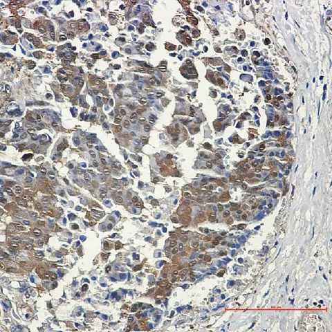 Recombinant 4E BP1 Monoclonal Antibody - 2