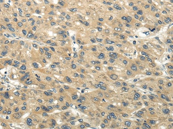 CHGB Polyclonal Antibody - small - 1