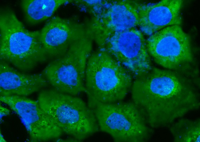 DARS Monoclonal Antibody - 2