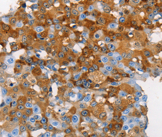 MUC5B Polyclonal Antibody - 1