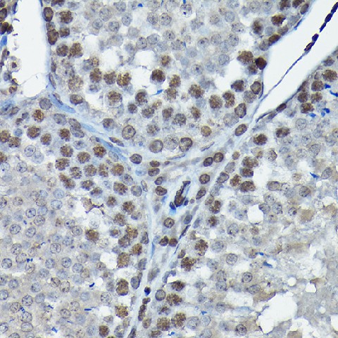 (KO Validated) CDK4 Polyclonal Antibody - small - 5