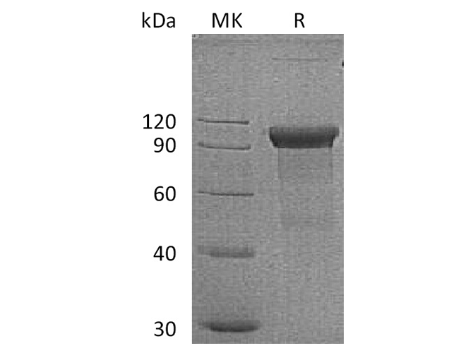 Recombinant Human ROR1 Protein (Fc Tag) - 1