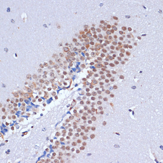 DNMT3L Polyclonal Antibody - 3