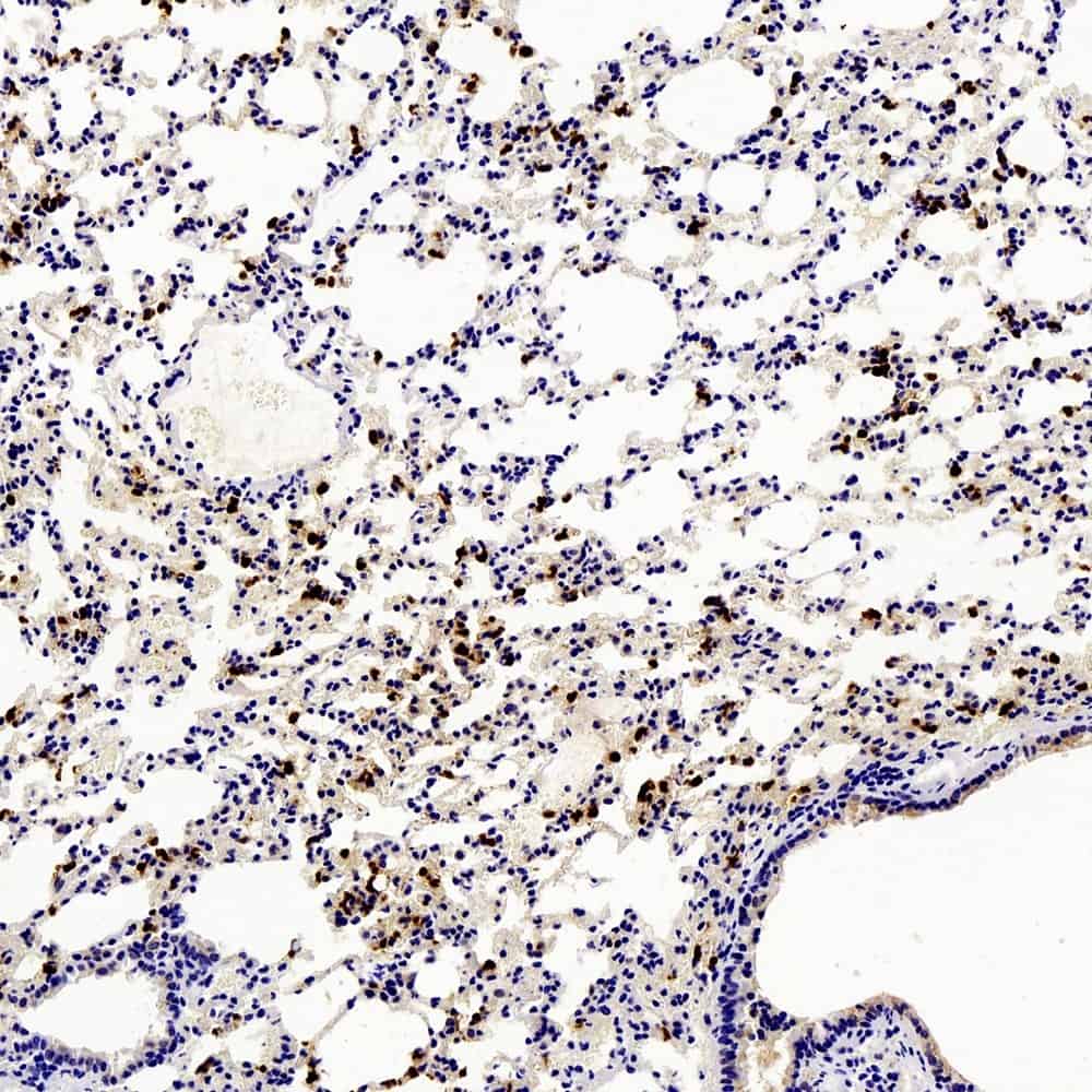 Ly6g Polyclonal Antibody - 1
