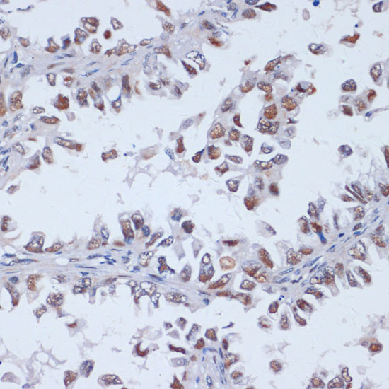 DNMT3L Polyclonal Antibody - 2