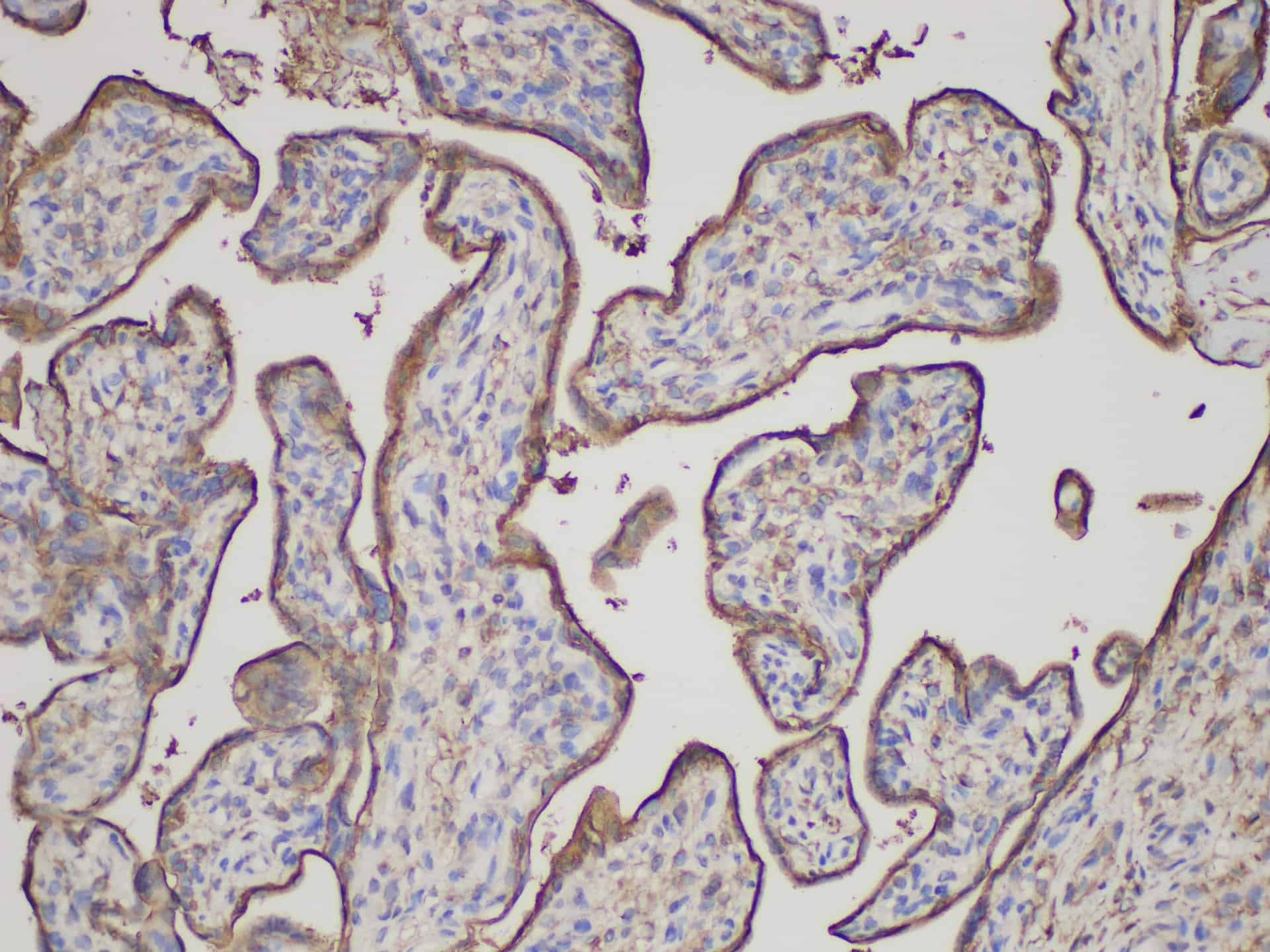 ANXA5 Polyclonal Antibody - 3