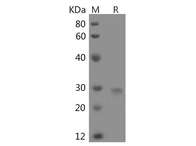 Recombinant Human Interferon γ/IFNG Protein - 1