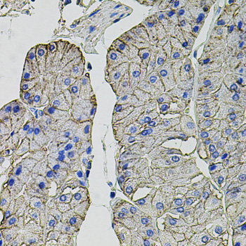 CA9 Polyclonal Antibody - 2