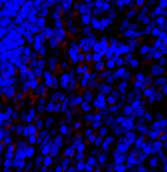SNAI1 Polyclonal Antibody - 2