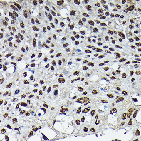 (KO Validated) CDK4 Polyclonal Antibody - 3