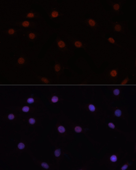 DNMT3B Polyclonal Antibody - 2