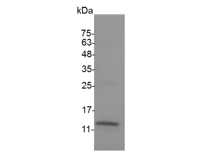 Recombinant Mouse TNF beta protein(His Tag) - 1