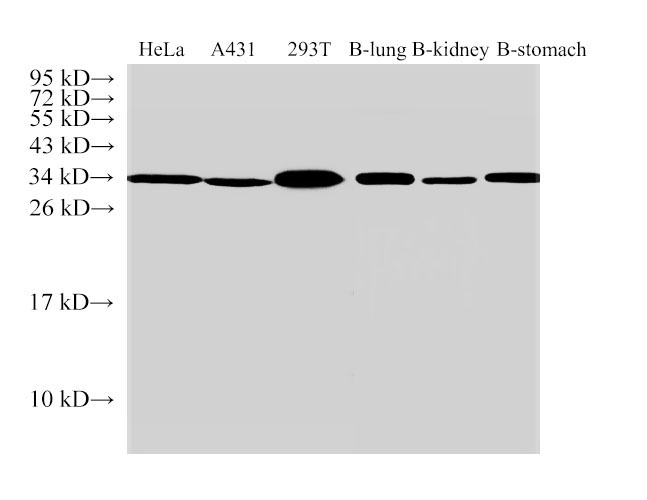 ANXA5 Polyclonal Antibody - 1