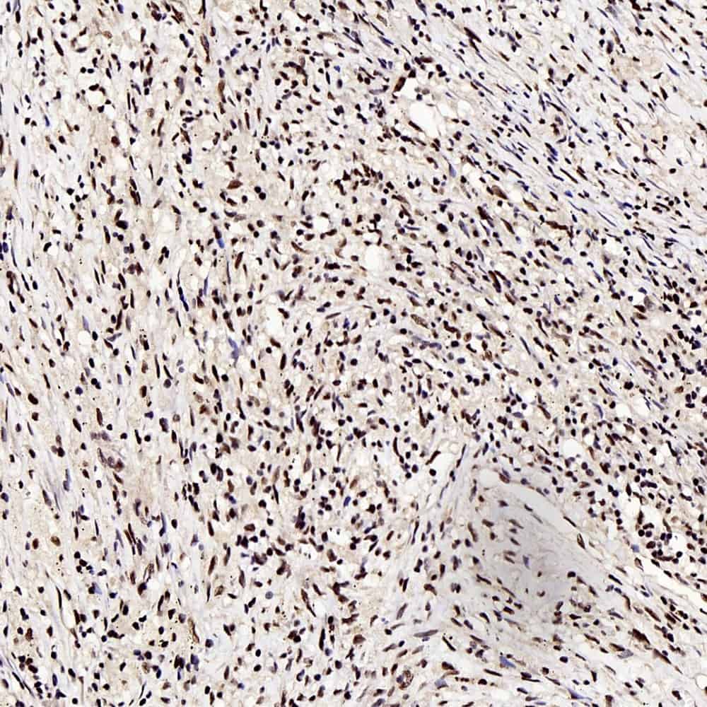 c-Fos Polyclonal Antibody - 1