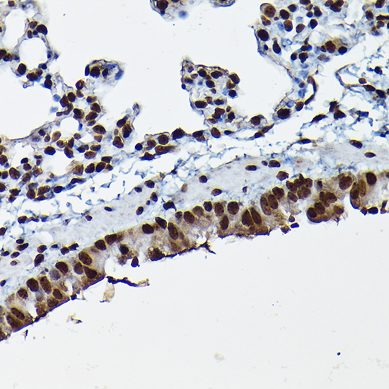 (KO Validated) CDK4 Polyclonal Antibody - small - 4