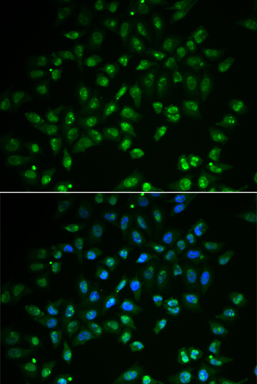 HAND2 Polyclonal Antibody - 2