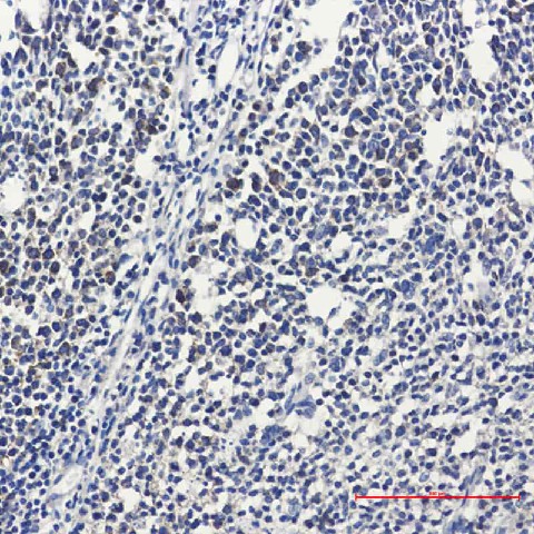 Recombinant RPS20 Monoclonal Antibody - 2