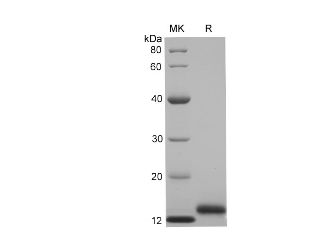 Recombinant Human CD59 glycoProtein Protein (His Tag) - 1