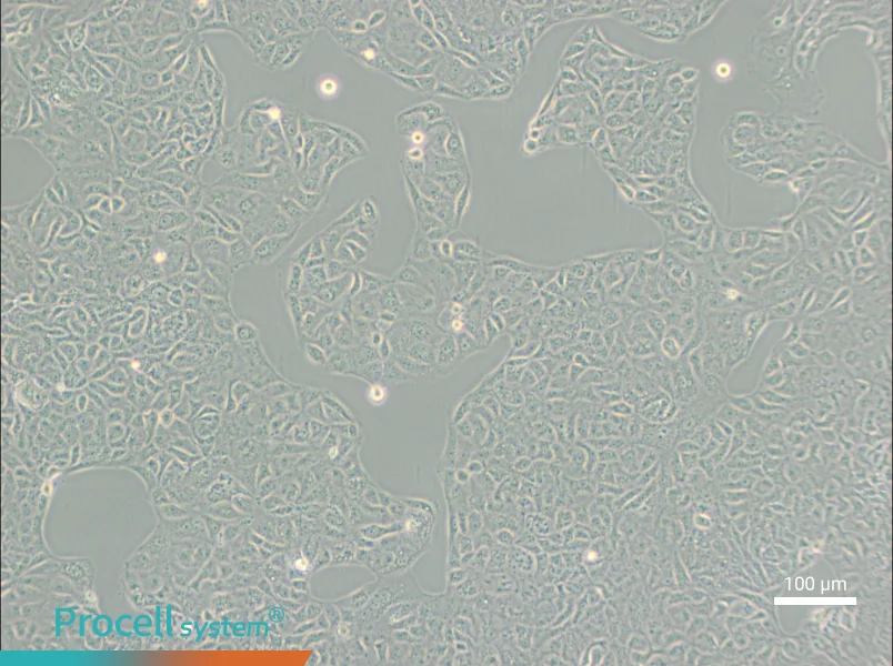 VERO C1008 [Vero E6] Cell Complete Medium - 1