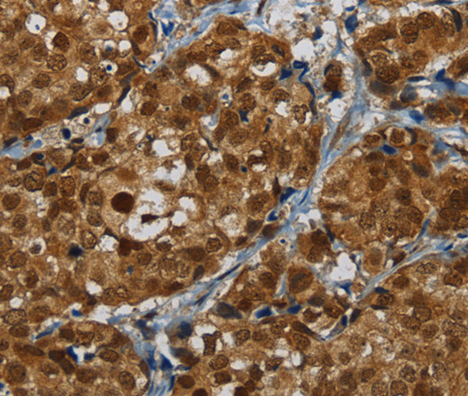 MRE11 Polyclonal Antibody - 2