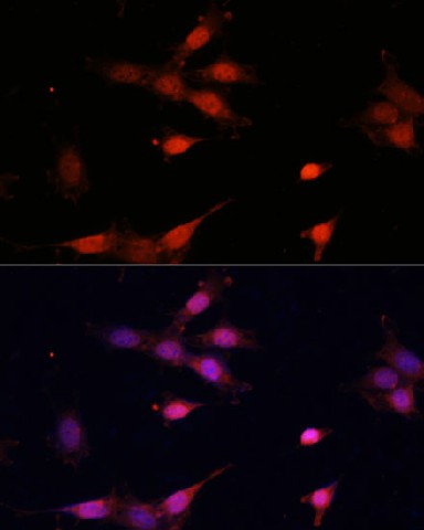 Bcl-2 Polyclonal Antibody - 2