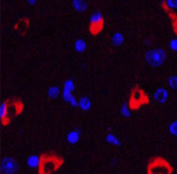 MAP2 Monoclonal Antibody - 2